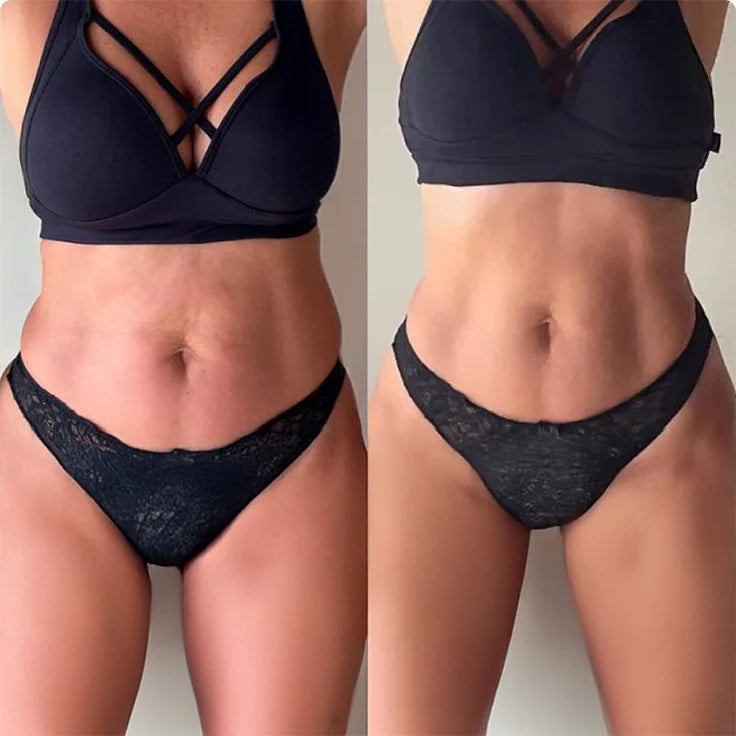 Before and after — Anna