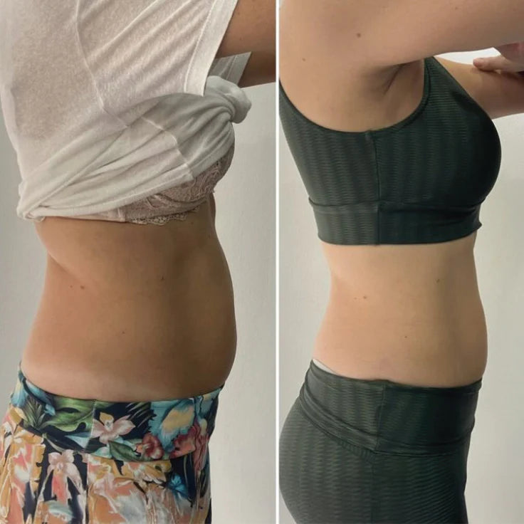 Before and after — Sara