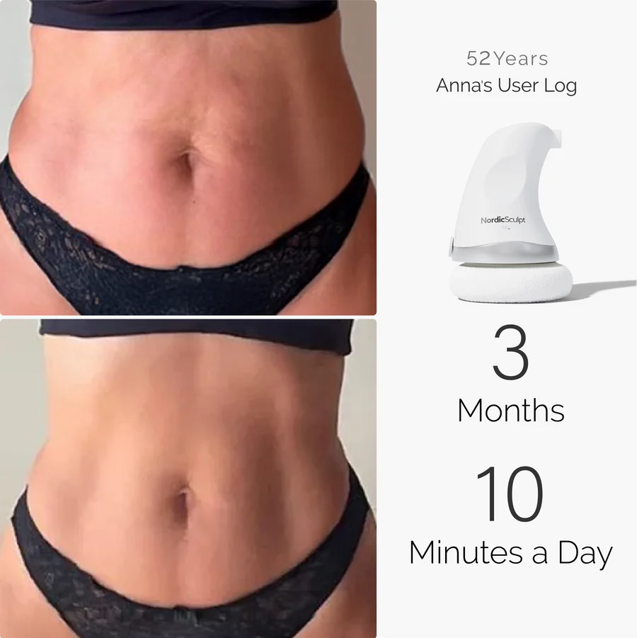 NordicSculpt Body Sculpting Device