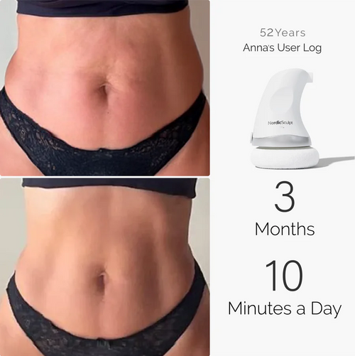 NordicSculpt Body Sculpting Device