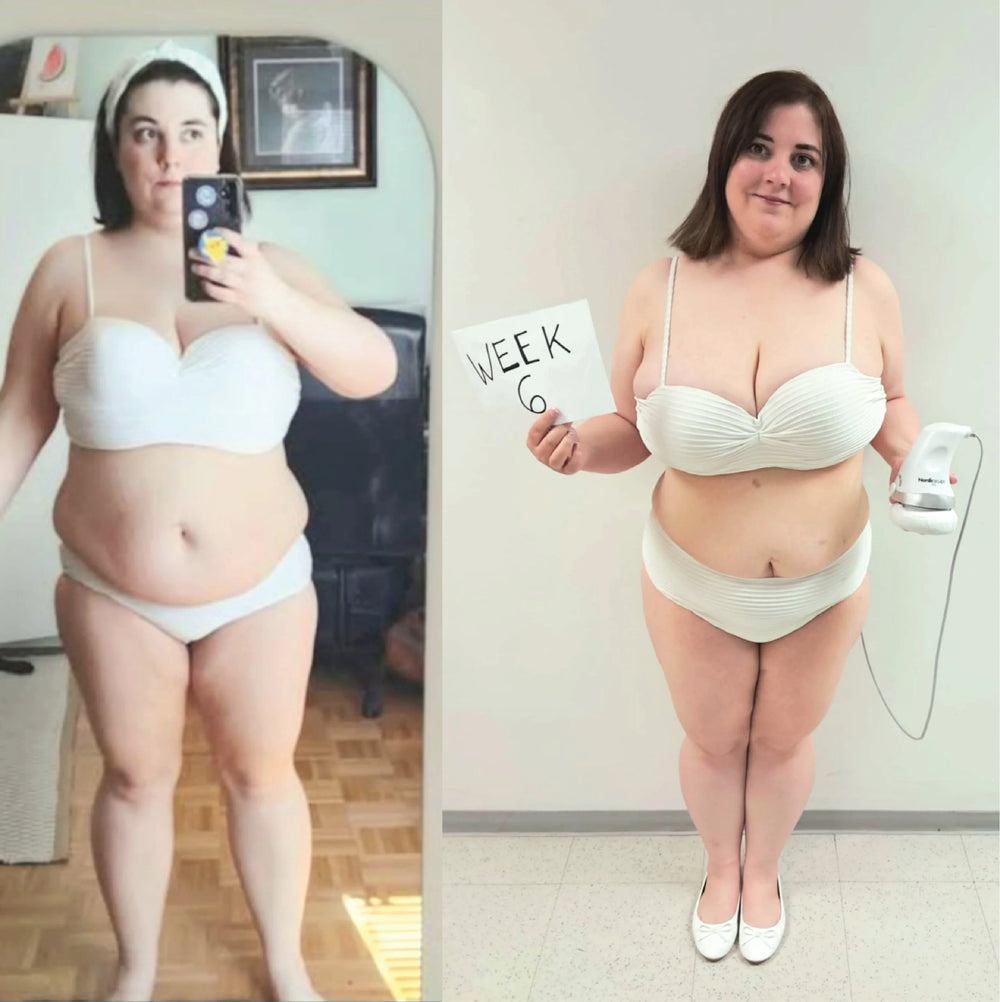 Before and after — Marie