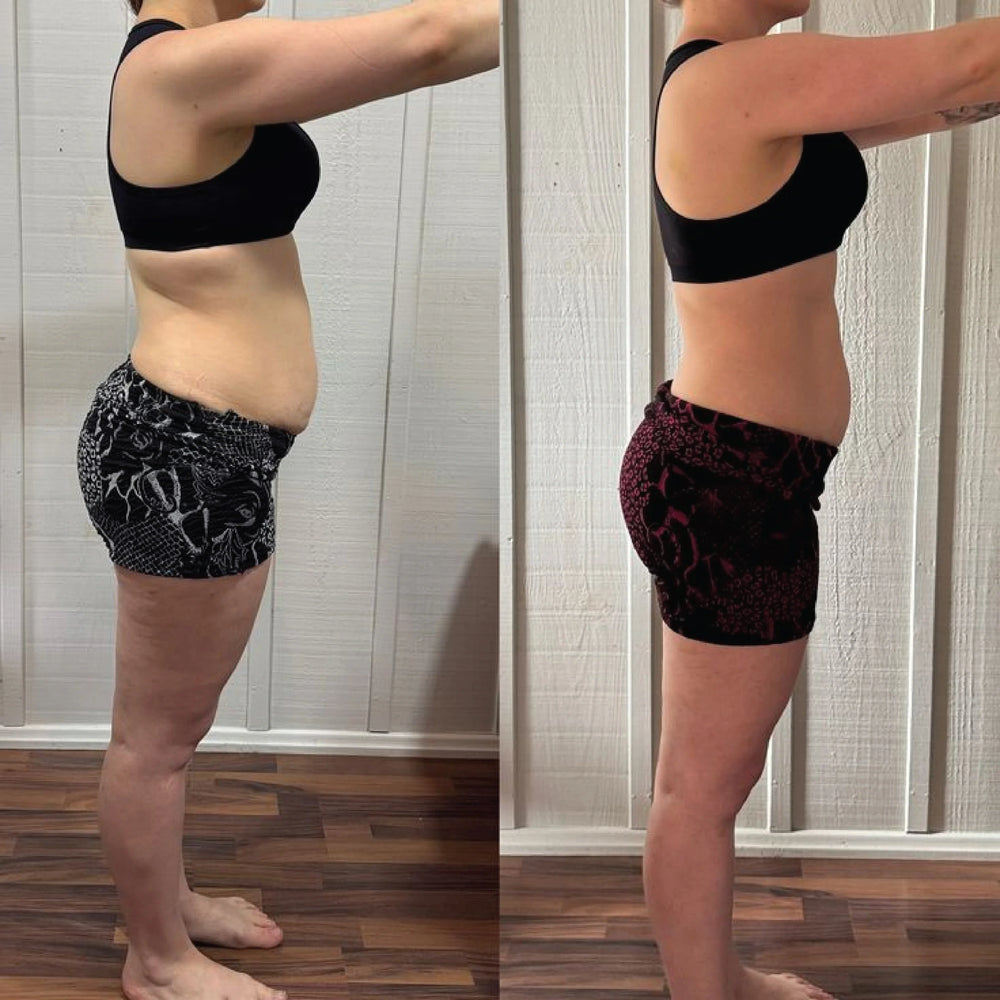 Before and after — Lisa